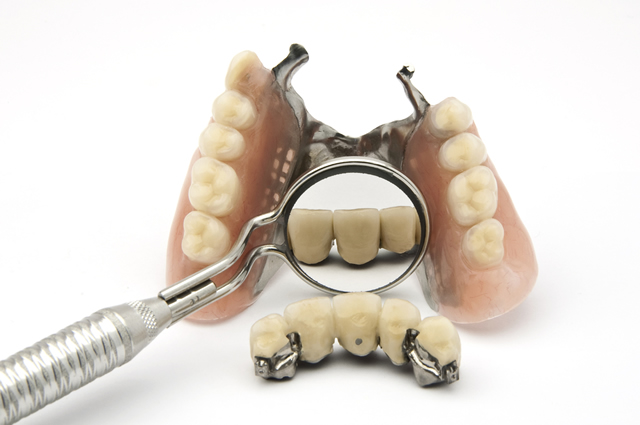 Denture Repairs