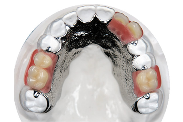 CHROME DENTURES PENRITH